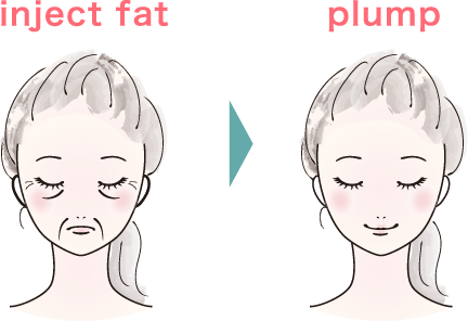 inject fat