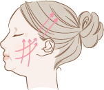 Smoothing deep nasolabial folds (smile lines)